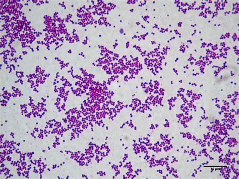 Staphylococcus aureus pod mikroskopom