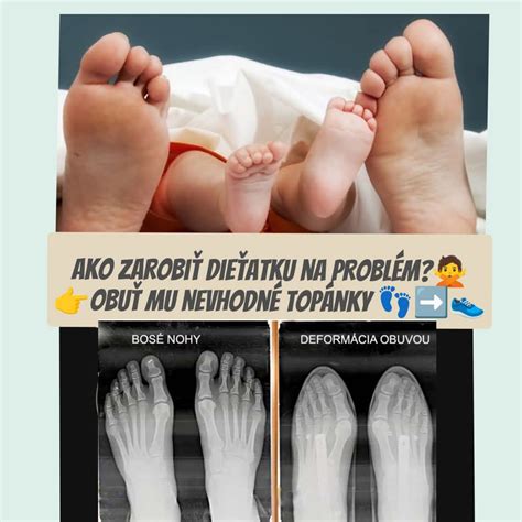kôň pri bezpečnom naťahovaní prednej nohy