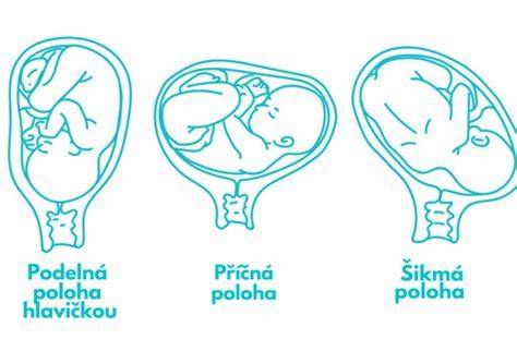 schéma polôh plodu pri pôrode
